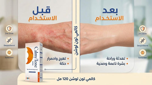 Before and after comparison of skin with a Calmylone product, showing irritation on the left and smooth skin on the right.