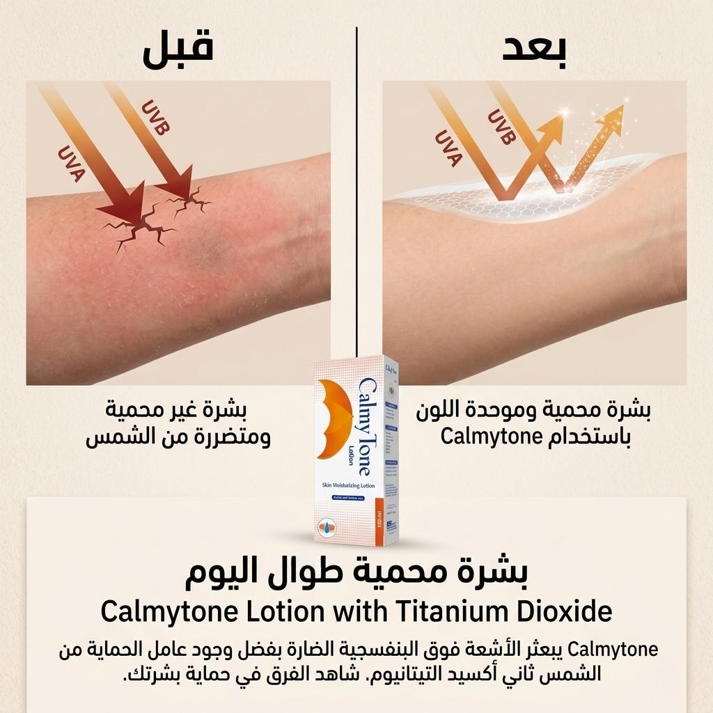 Before and after comparison of sunburned skin with Calmytone lotion packaging.
