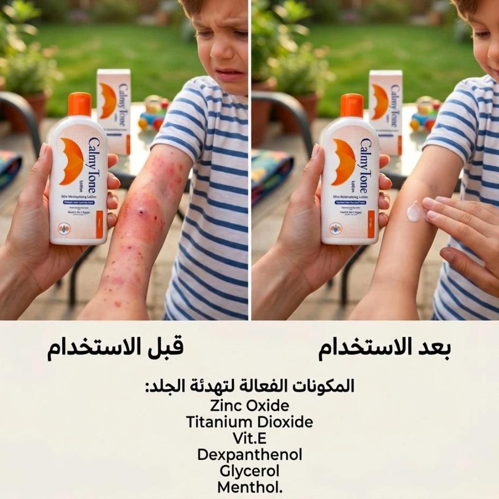 Child with insect bite on arm, Calamine lotion shown, before and after application, ingredients listed.